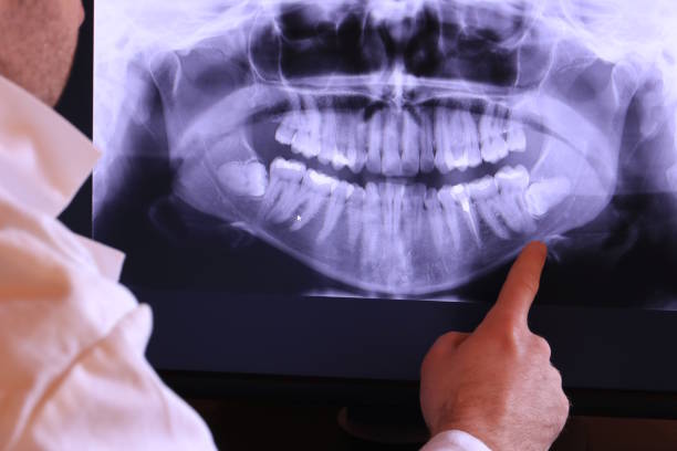 Best Mobile Emergency Dentist in Mentone, CA