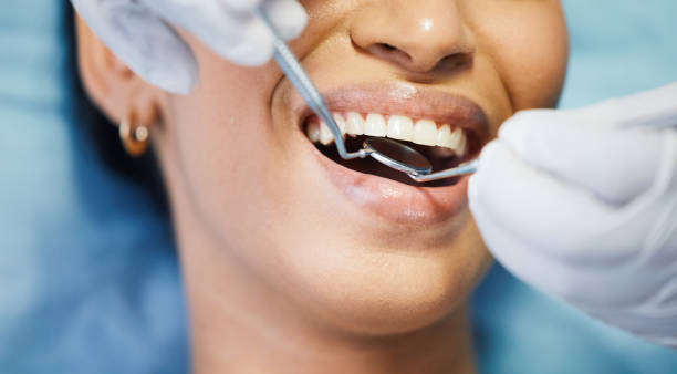 Best Emergency Dentist for Lost Fillings or Crowns in Mentone, CA