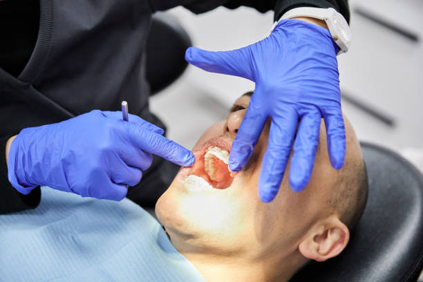 Best Emergency Dental Extractions in Mentone, CA